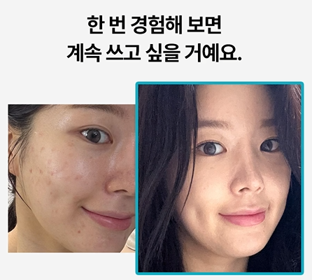 [Mediheal] Madecassoside Blemish Repair Serum (40 ml)
