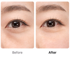 Medicube [Collagen RF] UltraTune 40.68, 1 Unit