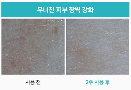 [Mediheal] Madecassoside Blemish Repair Serum (40 ml)