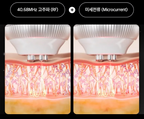 Medicube [Collagen RF] UltraTune 40.68, 1 Unit